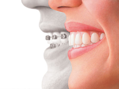 Benecchi Dental Group | Periodontal Treatment, Dentures and Pediatric Dentistry