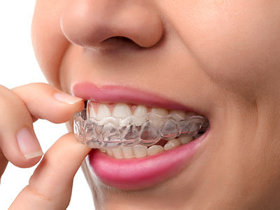 Benecchi Dental Group | Veneers, Cosmetic Dentistry and Pediatric Dentistry