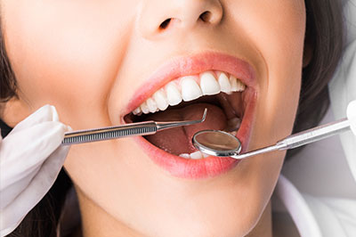 Benecchi Dental Group | Periodontal Treatment, Crowns  amp  Caps and Dental Bridges