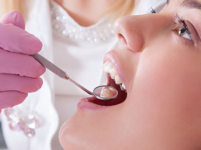 Benecchi Dental Group | Dentures, Extractions and Dental Bridges